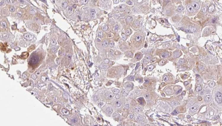 OR1E1 Antibody