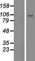 ZNF560 Protein (Over-Expression Lysate Myc-DDK (Flag))
