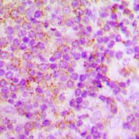 P40PHOX / NCF4 Antibody (Internal)