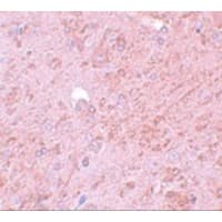 PIAS4 / PIASY Antibody