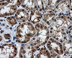 Monoclonal Mouse anti-Human BRAF / B-Raf Antibody (clone OTI1E2, IHC, IF, WB)