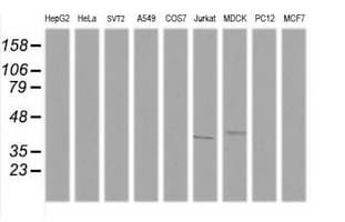 MAP2K3 / MEK3 / MKK3 Antibody (clone OTI3C3)