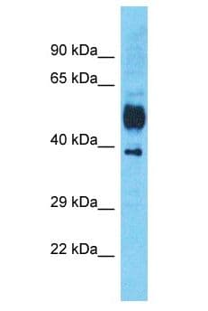 SLC9A3R1 / NHERF1 / EBP50 Antibody (aa287-336)