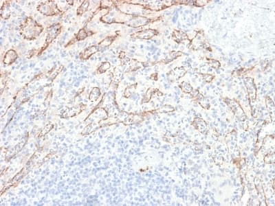 Recombinant Monoclonal Rabbit anti-Human TNFSF15 / TL1A / VEGI Antibody (clone VEGI/2052R, IHC)