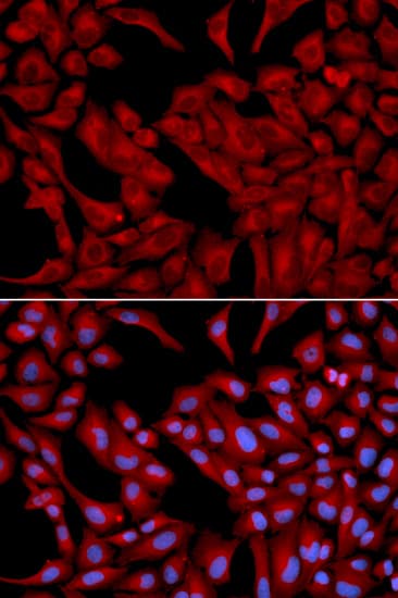 Polyclonal Rabbit anti-Human Dynactin 2 / Dynamitin Antibody (IHC, IF, WB)