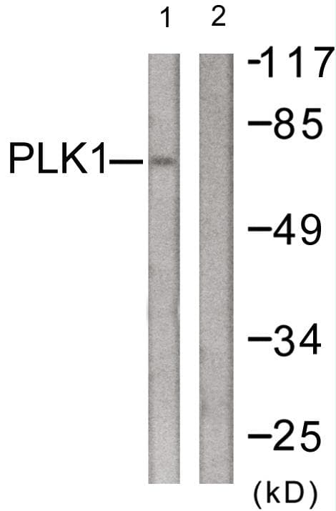 PLK1 / PLK-1 Antibody (p210)