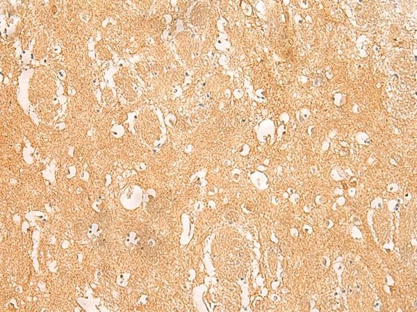 Polyclonal Rabbit anti-Human ARPC5L Antibody (IHC)