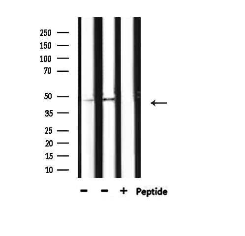Polyclonal Rabbit anti-Human HDAC3 Antibody (phospho-Ser424, IHC, IF, WB)