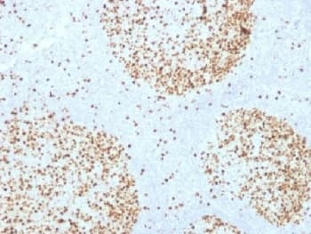 Monoclonal Mouse anti-Human TOP2A / Topoisomerase II Alpha Antibody (clone TOP2A/1361, IHC, IF, WB)