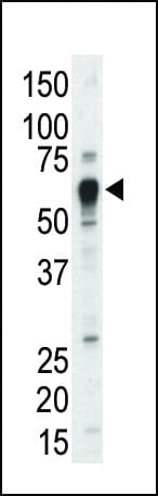 TEC Antibody (aa175-205)