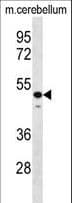 STAMBP / AMSH Antibody (aa355-383)