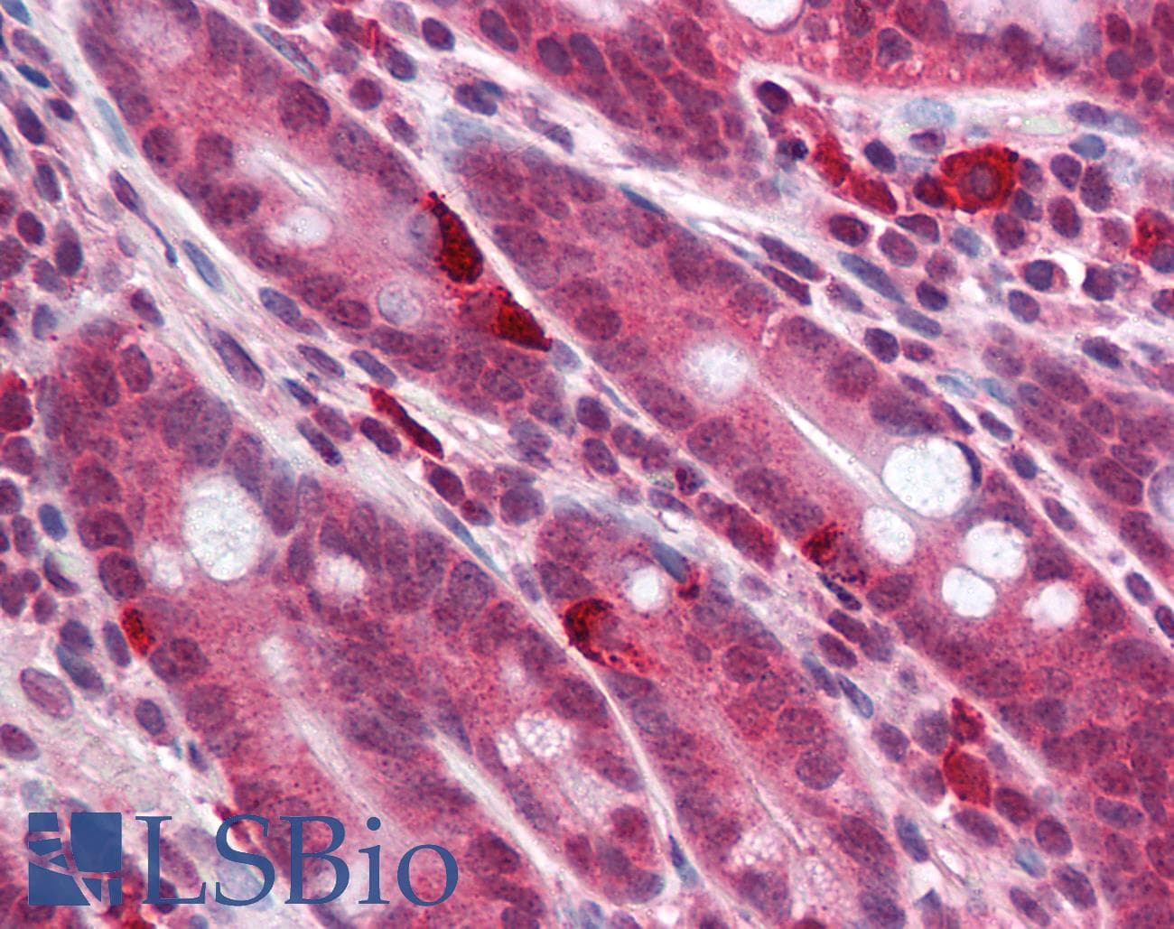 IHC-plus™ MC4R / Melanocortin 4 Receptor Antibody (aa21-33)