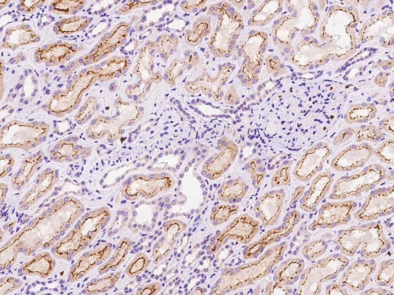 Polyclonal Rabbit anti-Human GABRE Antibody (IHC)