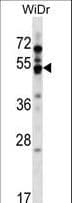 Polyclonal Rabbit anti-Human GPR84 Antibody (aa265-293, WB)