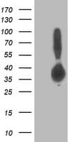 ALDOB Antibody (clone OTI2A3)