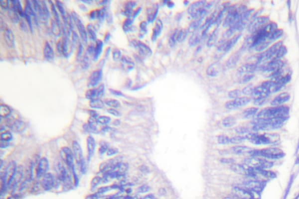 PTK2B / PYK2 Antibody (Ile574)