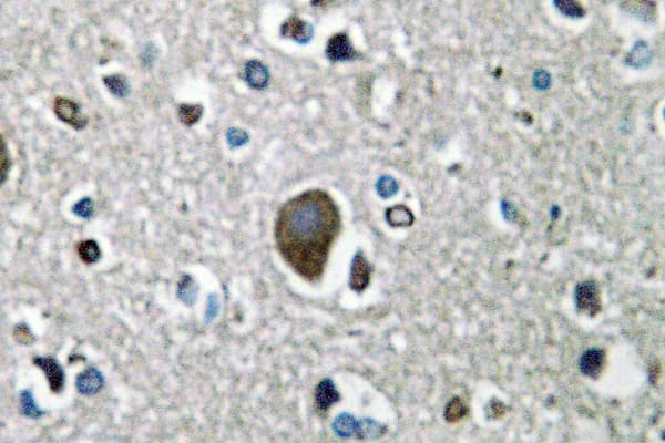 AKAP1 / AKAP Antibody (Asn306)