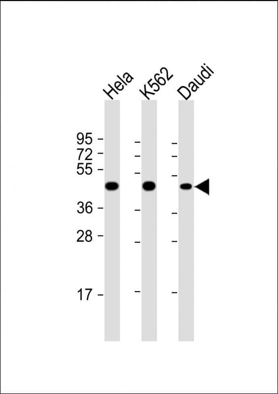 PLIN3 / M6PRBP1 / TIP47 Antibody (clone 1651CT157.85.94)