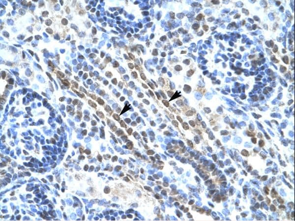 ANKRD11 Antibody (aa57-106)