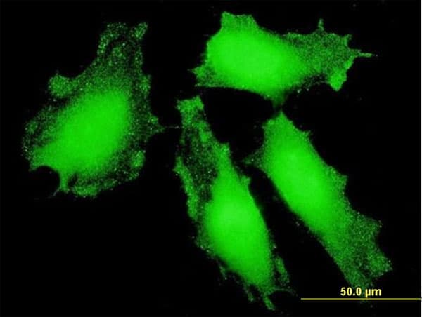 IHC-plus™ Monoclonal Mouse anti-Human FOXO3 / FOXO3A Antibody (clone 2C5, IHC, IF, WB)
