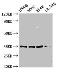 PRDX5 / Peroxiredoxin 5 Antibody