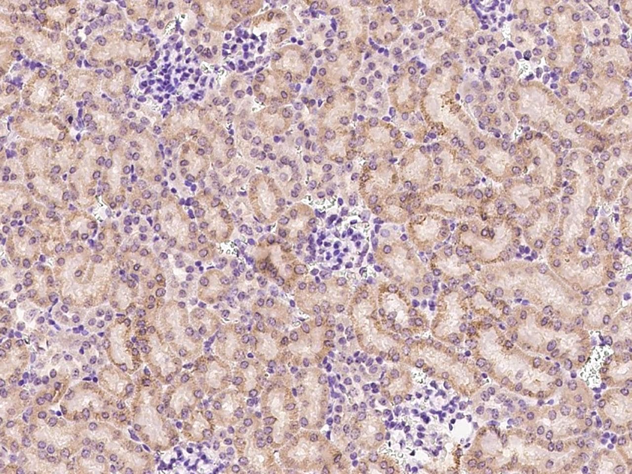 Polyclonal Rabbit anti-Human AIF1L Antibody (IHC)