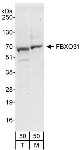FBXO31 Antibody (aa489-539)