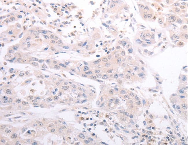 CIDEB Antibody