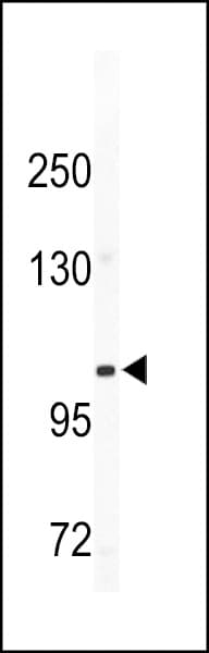 Polyclonal Rabbit anti-Human ITGA5/Integrin Alpha 5/CD49e Antibody (aa796-824, WB)