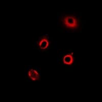 RARS Antibody