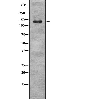 Polyclonal Rabbit anti-Human KCNMA1 / BK Antibody (IHC, WB)