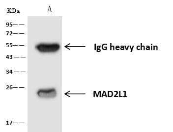 Polyclonal Rabbit anti-Human MAD2L1 / MAD2 Antibody (IHC, IF, WB)