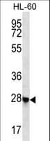 RITA1 / C12orf52 Antibody (aa44-72)
