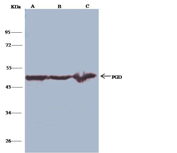 Polyclonal Rabbit anti-Human PGD Antibody (Preservative Free, IHC, IF, WB)