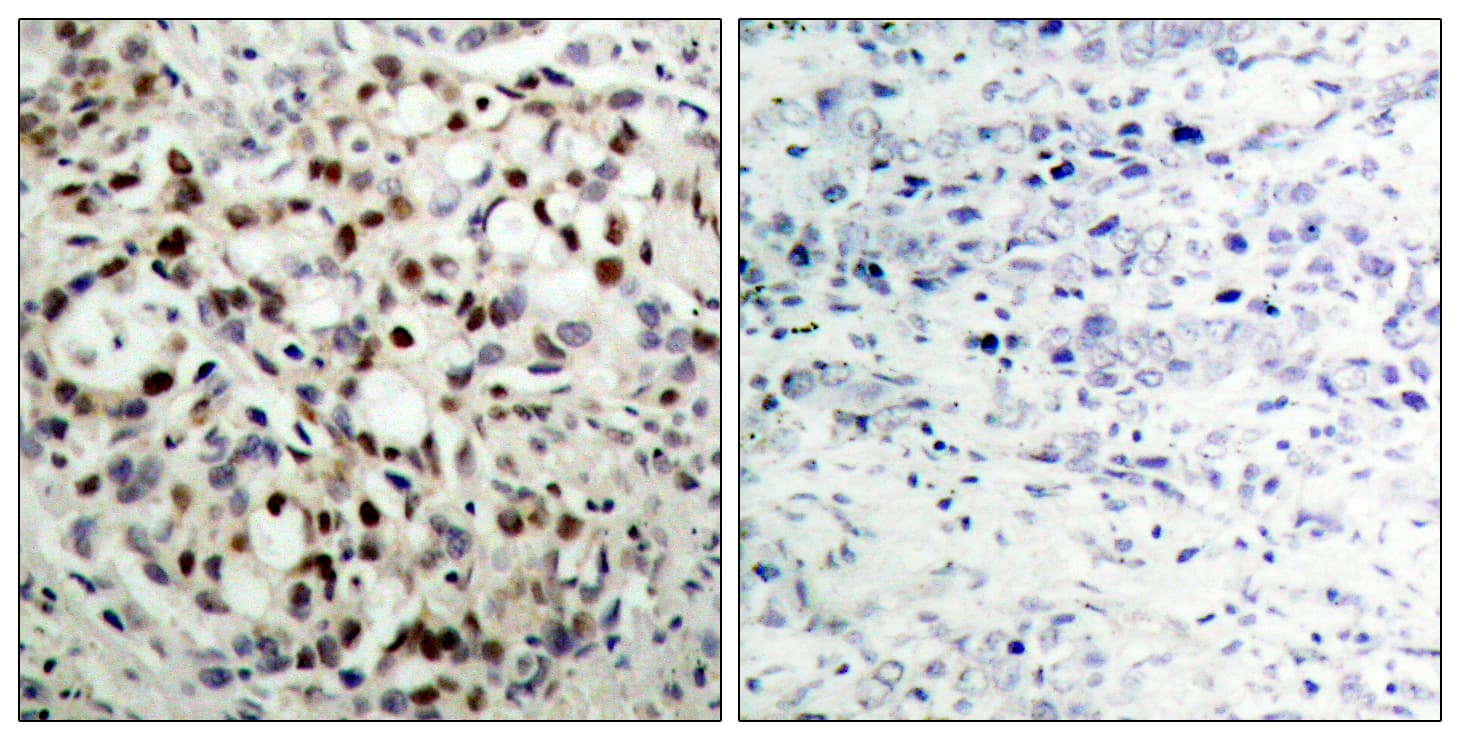 CREB1 / CREB Antibody (phospho-Ser133)