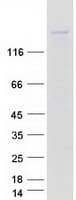 Human KIF16B Protein (Recombinant Myc-DDK (Flag))