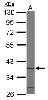 Polyclonal Rabbit anti-Human ACMSD Antibody (aa105-336, IHC, WB)