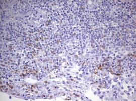 Monoclonal Mouse anti-Human CD8A / CD8 Alpha Antibody (clone OTI7C10, aa22-182, IHC, WB)