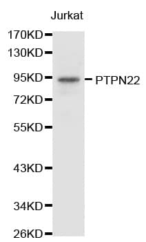 PTPN22 / PEP Antibody