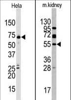 Polyclonal Rabbit anti-Human JMJD4 Antibody (aa423-455, IHC, WB)