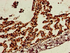 SKIL / SNO / SnoN Antibody