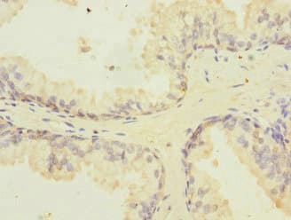 PPIL2 / CYP60 Antibody