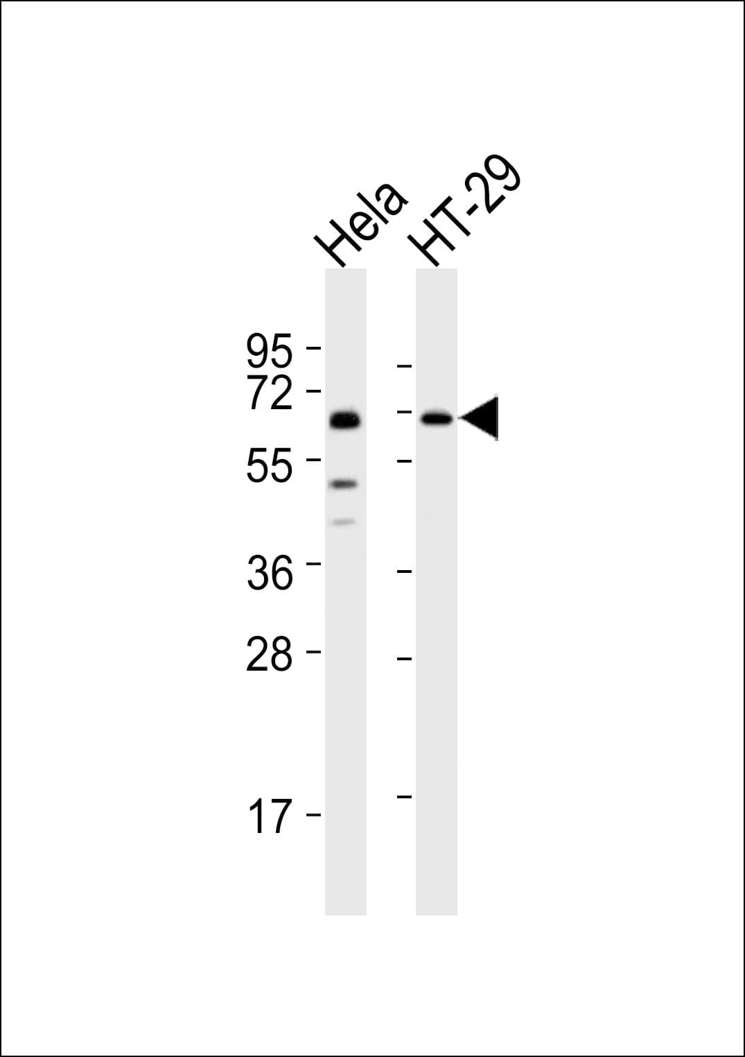 GBP3 Antibody