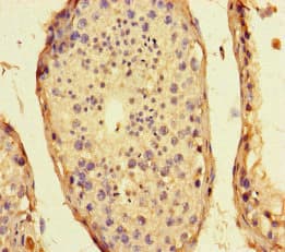 CEP104 Antibody