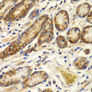 Polyclonal Rabbit anti-Human CAPNS1 / CAPN4 Antibody (IHC, WB)