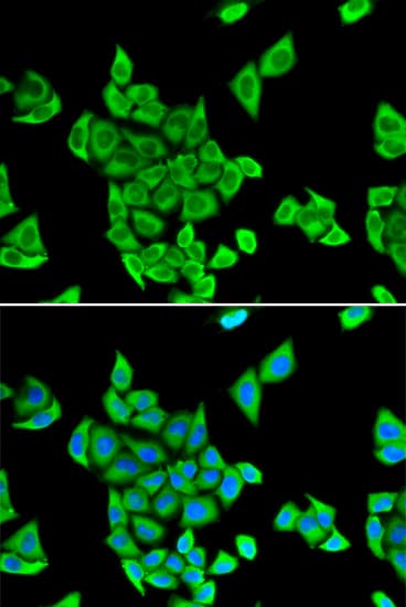 CIAPIN1 / Anamorsin Antibody