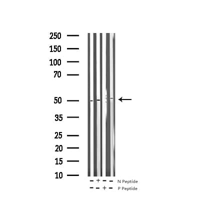 VASP Antibody (phospho-Ser157)
