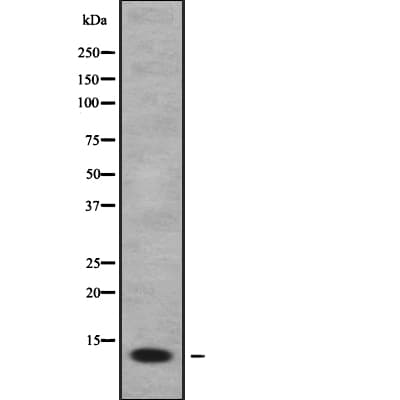 FDC-SP / C4orf7 Antibody