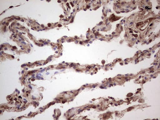 IGF1 Antibody (aa1-151, clone OTI3A6)