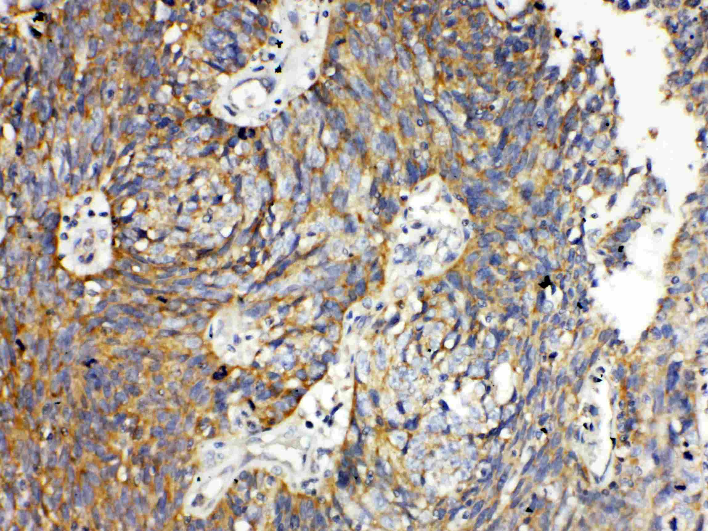 TNFRSF11A / RANK Antibody